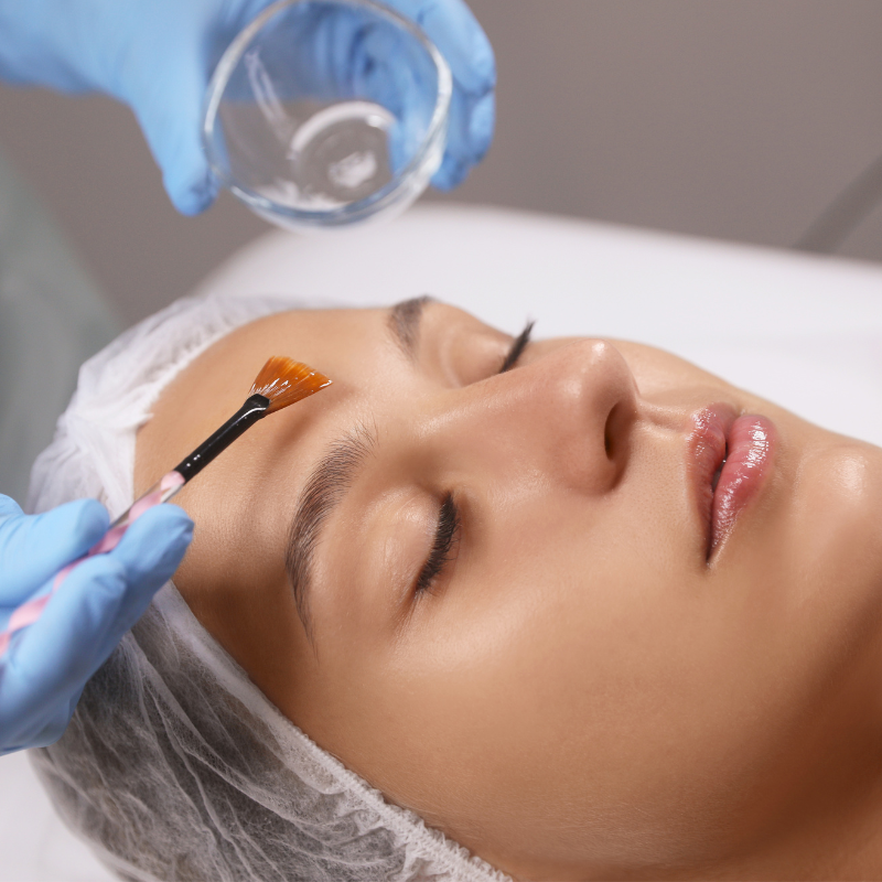CHEMICAL PEEL