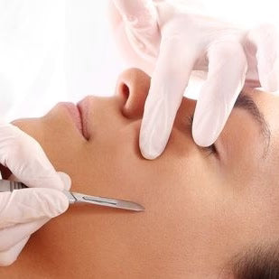 DERMAPLANING - EDMONTON
