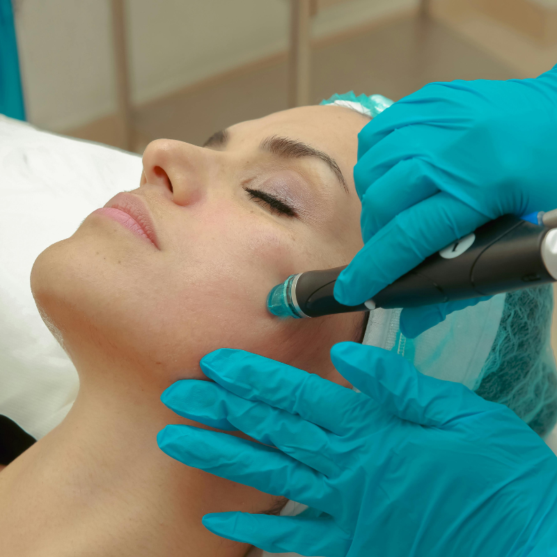 HYDRADERMABRASION